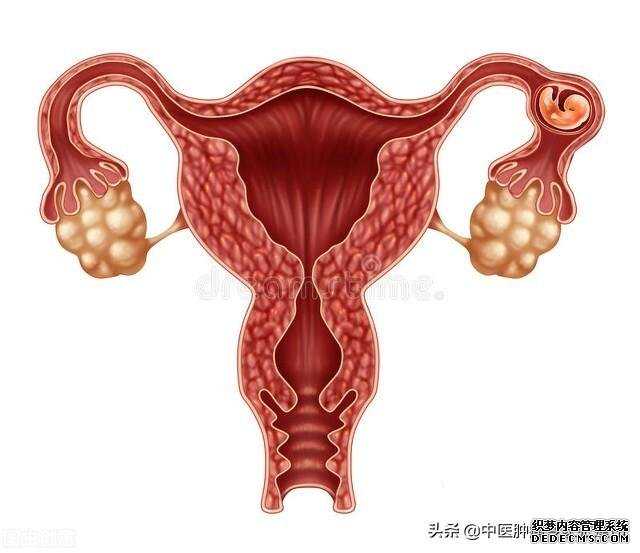 45岁女子下腹胀痛半个月，以为是小毛病，检查发现是卵巢癌
