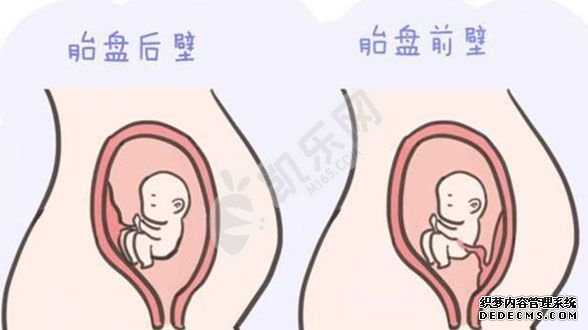杭州代怀生机构孕妈妈,2022年无锡市妇幼保健院试管怎么样