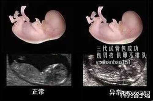 杭州代怀孕一般多少钱,宝宝吞了不同异物的症状表现