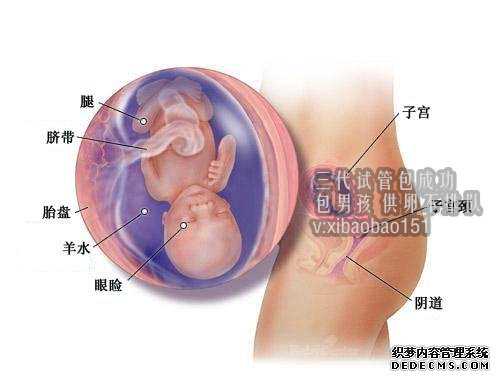 杭州代怀孕助孕哪里好,孕妇的痔疮的5个原因