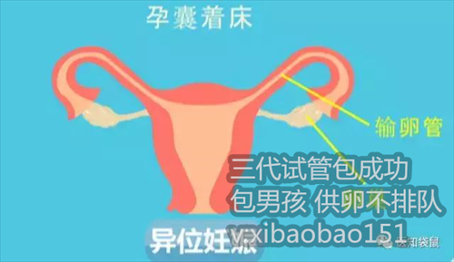 最新杭州代怀孕价格表介绍,孕妇的痔疮的5个原因